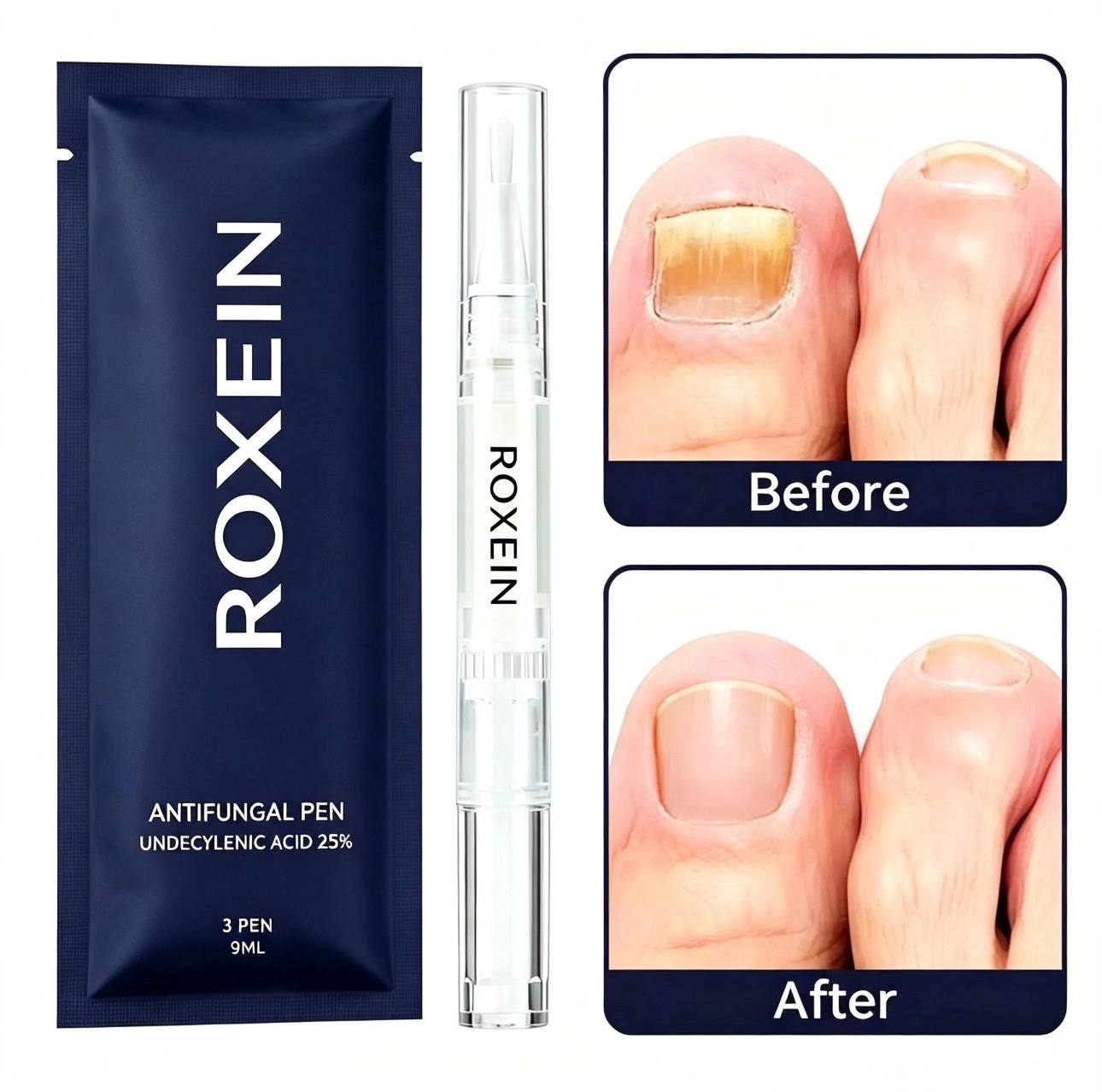 ROXEIN™ Nail Renewal Pen