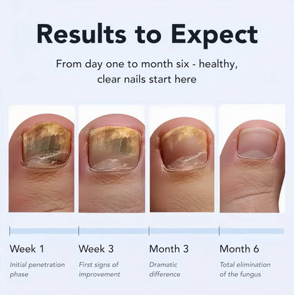ROXEIN™ Nail Renewal Pen