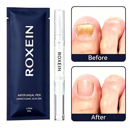 ROXEIN™ Nail Renewal Pen